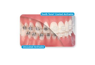 Tooth Tone Coated Nickel Titanium Full Form Archwire Rectangle